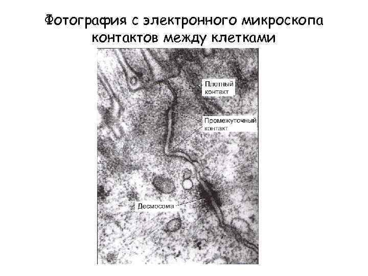 Фотография с электронного микроскопа контактов между клетками 