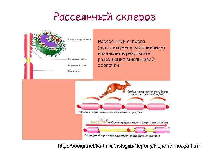 Рассеянный склероз http: //900 igr. net/kartinki/biologija/Nejrony-mozga. html 