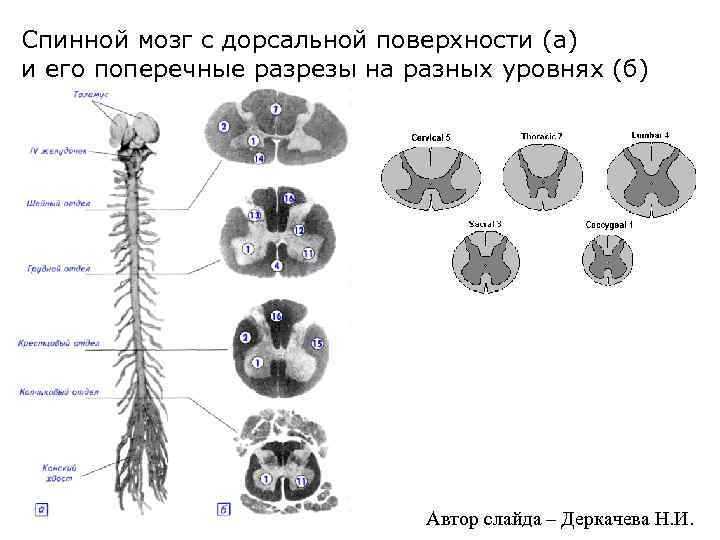 Спинной мозг с дорсальной поверхности (а) и его поперечные разрезы на разных уровнях (б)