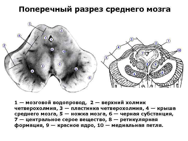 Поперечный срез среднего мозга схема