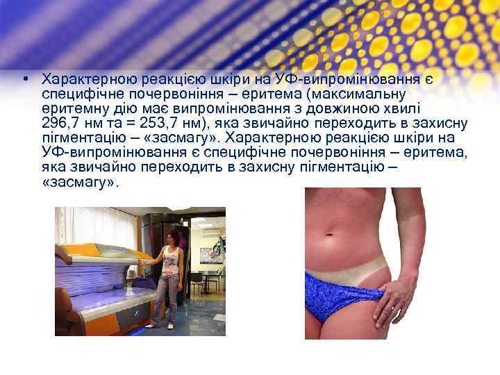  • Характерною реакцією шкіри на УФ-випромінювання є специфічне почервоніння — еритема (максимальну еритемну
