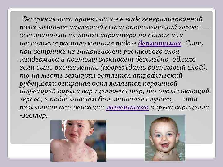Ветряная оспа проявляется в виде генерализованной розеолезно-везикулезной сыпи; опоясывающий герпес — высыпаниями сливного характера