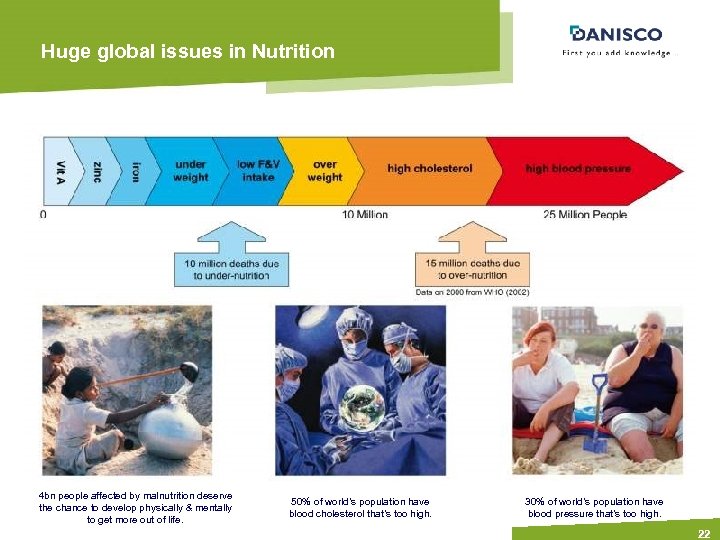 Huge global issues in Nutrition 4 bn people affected by malnutrition deserve the chance