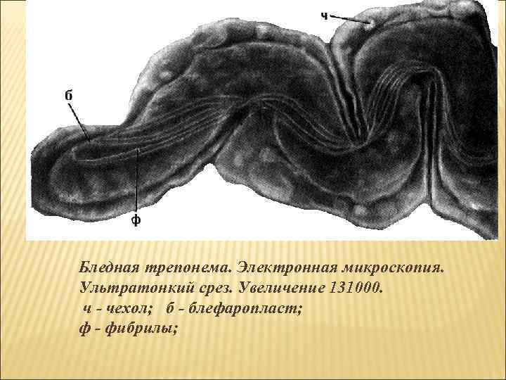 Бледная трепонема. Электронная микроскопия. Ультратонкий срез. Увеличение 131000. ч - чехол; б - блефаропласт;