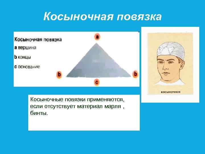 Косыночная повязка Косыночные повязки применяются, если отсутствует материал марля , бинты. 