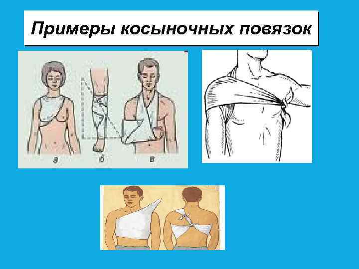 Примеры косыночных повязок 