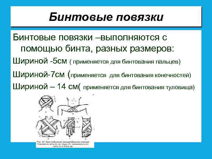 Бинтовые повязки –выполняются с помощью бинта, разных размеров: Шириной -5 см ( применяется для