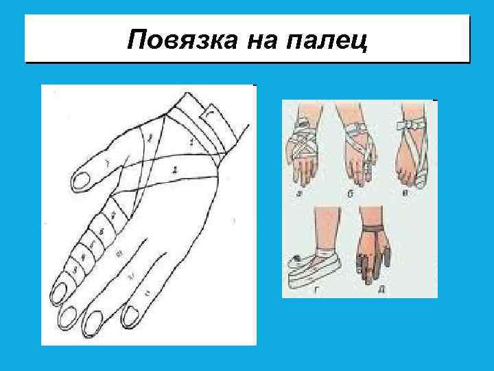 Повязка на палец 