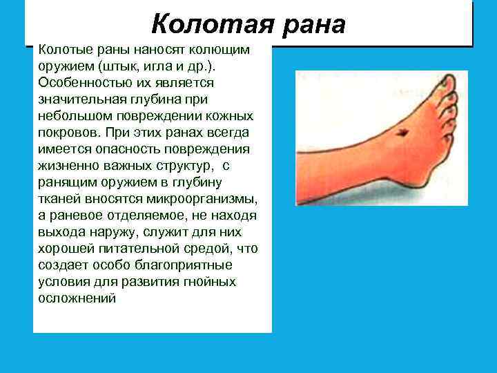 Колотая рана Колотые раны наносят колющим оружием (штык, игла и др. ). Особенностью их