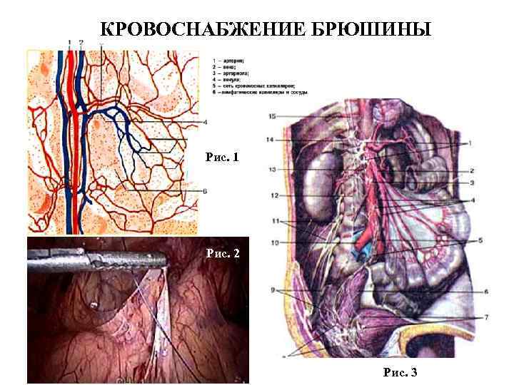 КРОВОСНАБЖЕНИЕ БРЮШИНЫ Рис. 1 Рис. 2 Рис. 3 