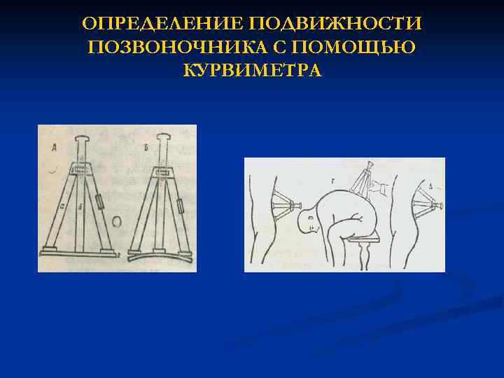 Чем определяется подвижность костей