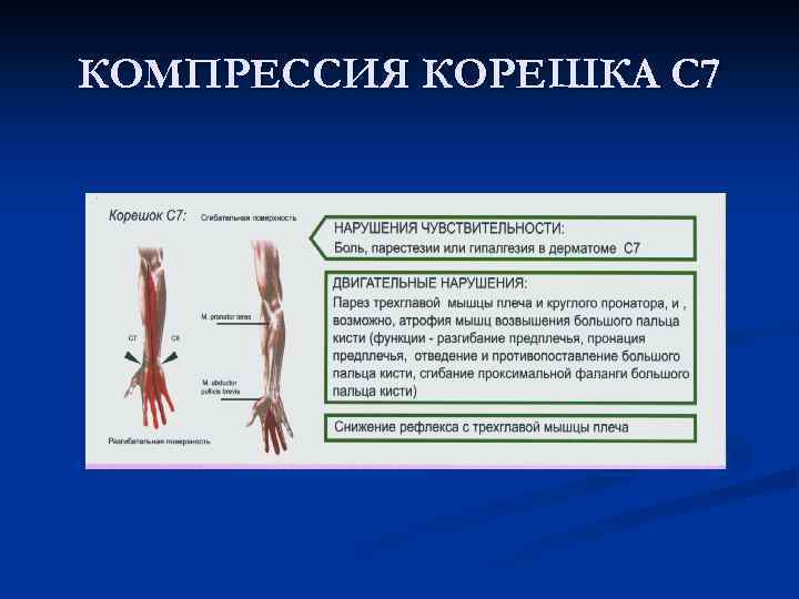 Сдавление корешков