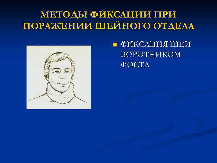 МЕТОДЫ ФИКСАЦИИ ПРИ ПОРАЖЕНИИ ШЕЙНОГО ОТДЕЛА n ФИКСАЦИЯ ШЕИ ВОРОТНИКОМ ФОСТА 