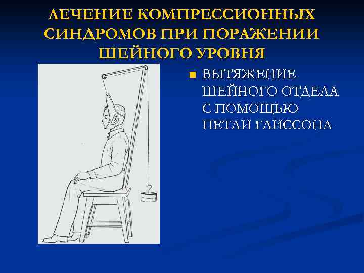 ЛЕЧЕНИЕ КОМПРЕССИОННЫХ СИНДРОМОВ ПРИ ПОРАЖЕНИИ ШЕЙНОГО УРОВНЯ n ВЫТЯЖЕНИЕ ШЕЙНОГО ОТДЕЛА С ПОМОЩЬЮ ПЕТЛИ