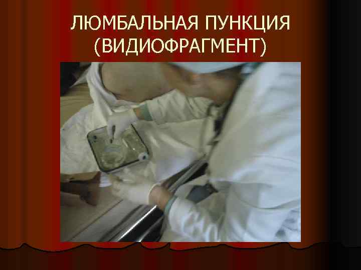 ЛЮМБАЛЬНАЯ ПУНКЦИЯ (ВИДИОФРАГМЕНТ) 