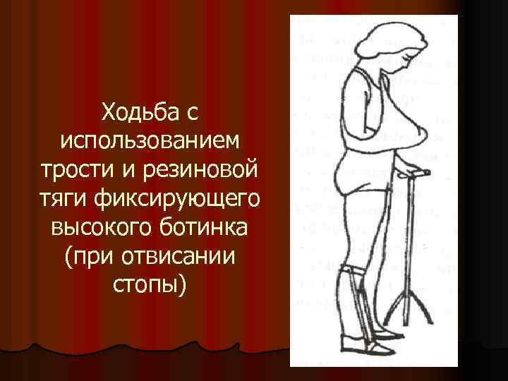 Ходьба с использованием трости и резиновой тяги фиксирующего высокого ботинка (при отвисании стопы) 
