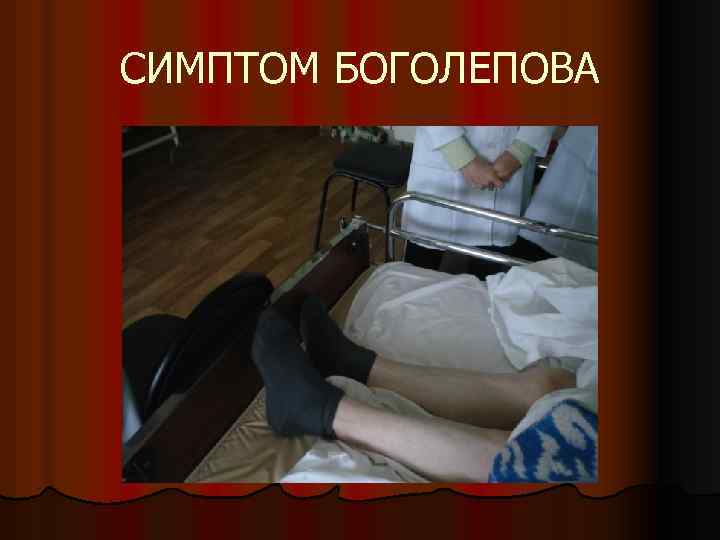 СИМПТОМ БОГОЛЕПОВА 