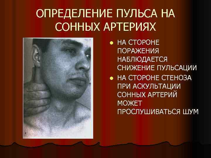 ОПРЕДЕЛЕНИЕ ПУЛЬСА НА СОННЫХ АРТЕРИЯХ НА СТОРОНЕ ПОРАЖЕНИЯ НАБЛЮДАЕТСЯ СНИЖЕНИЕ ПУЛЬСАЦИИ l НА СТОРОНЕ