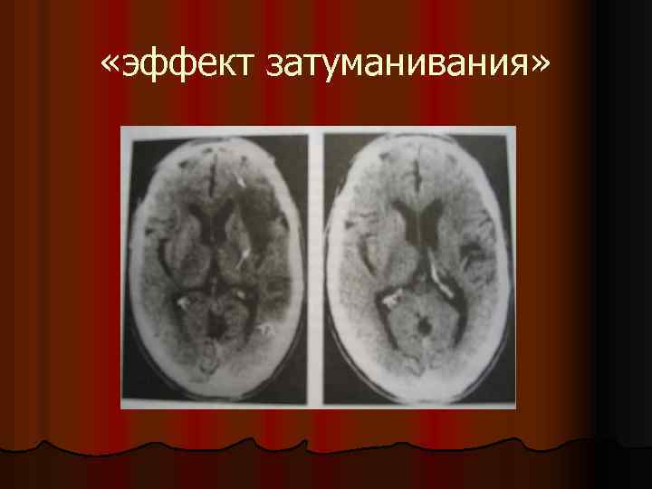  «эффект затуманивания» 