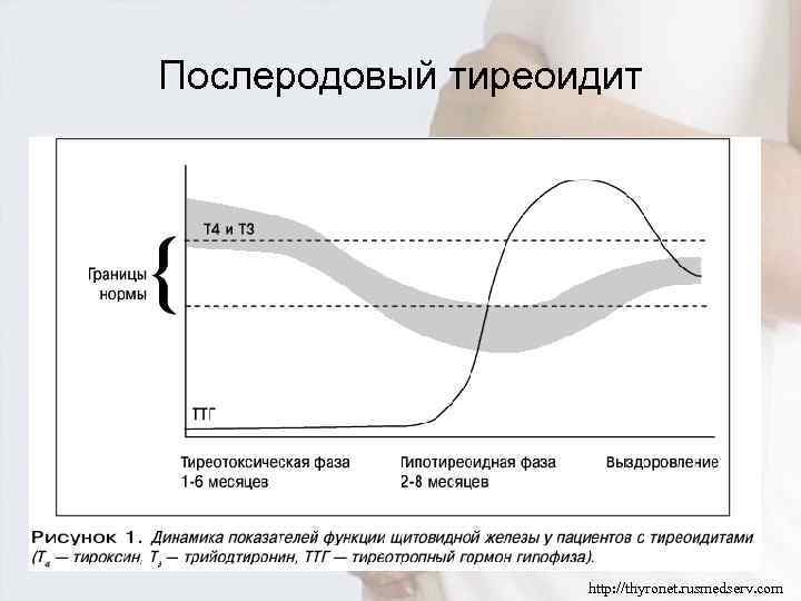 Послеродовый тиреоидит. АИТ тиреотоксическая фаза. Аутоиммунный тиреоидит тиреотоксическая фаза. Послеродовый тиреоидит этиология.