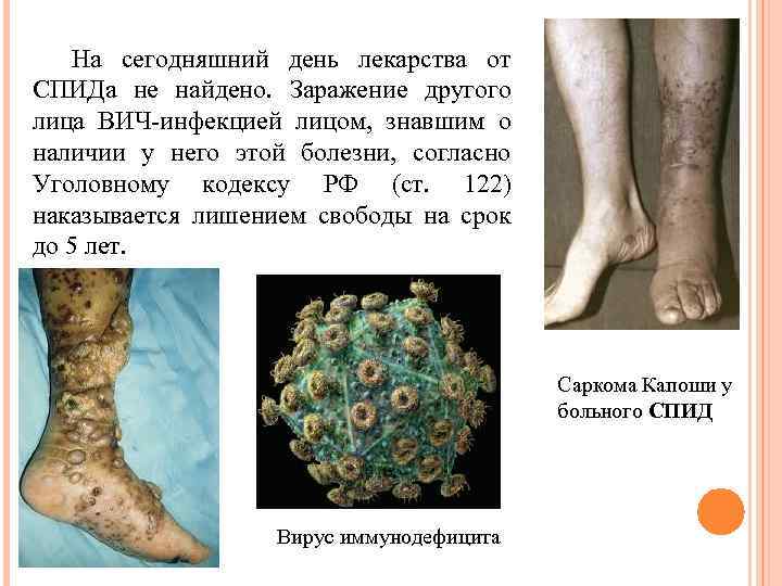 На сегодняшний день лекарства от СПИДа не найдено. Заражение другого лица ВИЧ-инфекцией лицом, знавшим