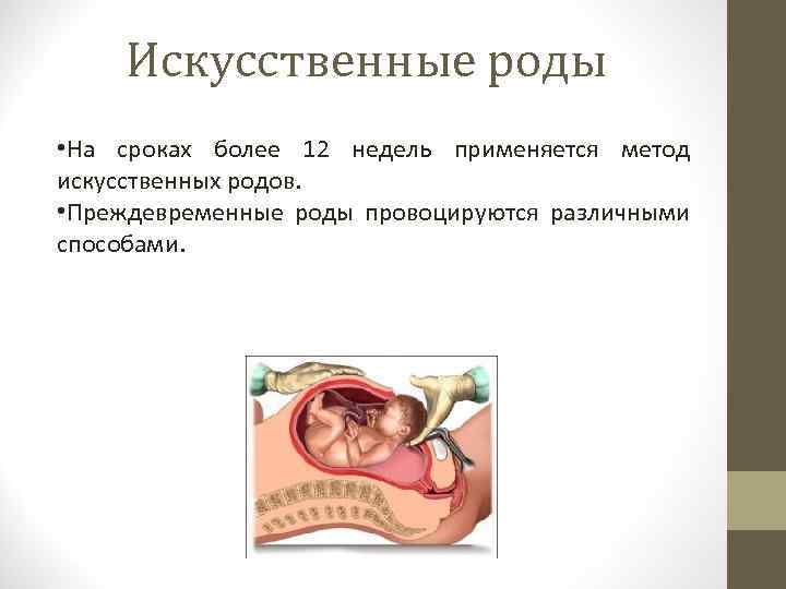 Искусственные роды • На сроках более 12 недель применяется метод искусственных родов. • Преждевременные