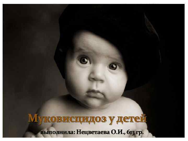 Муковисцидоз у детей выполнила: Нецветаева О. И. , 613 гр. 