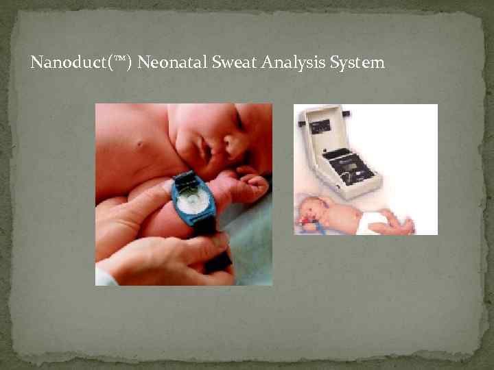 Nanoduct(™) Neonatal Sweat Analysis System 