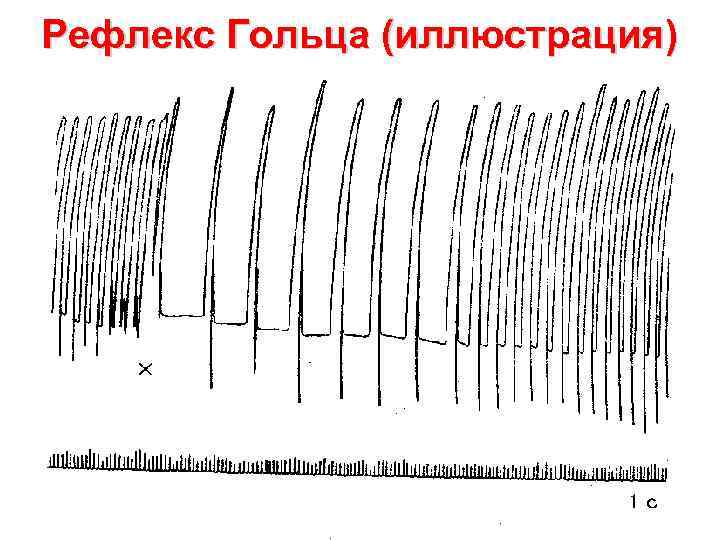 Рефлекс Гольца (иллюстрация) 