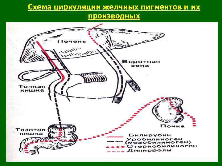 Механизмы нарушения лимфообращения схема