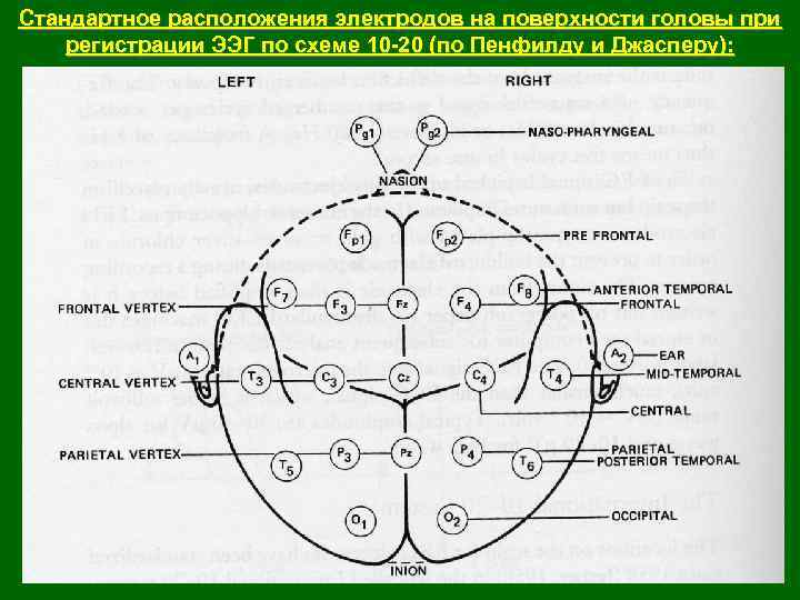 Стандартное расположения электродов на поверхности головы при регистрации ЭЭГ по схеме 10 20 (по