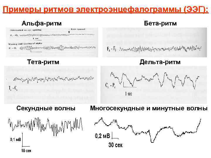 Альфа ритм. ЭЭГ Альфа бета тета Дельта ритмы. Электроэнцефалограмма Альфа и бета ритмы. МЮ ритм на ЭЭГ. Альфа ритм бета ритм тета ритм Дельта ритм ЭЭГ.