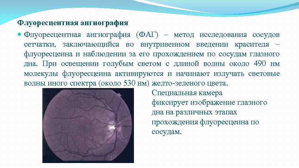 Флуоресцентная ангиография (ФАГ) – метод исследования сосудов сетчатки, заключающийся во внутривенном введении красителя –