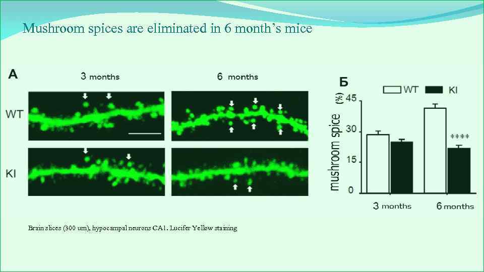 Mushroom spices are eliminated in 6 month’s mice Brain slices (300 um), hypocampal neurons