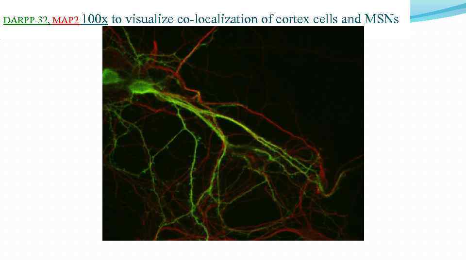 DARPP-32, MAP 2 100 х to visualize co-localization of cortex cells and MSNs 