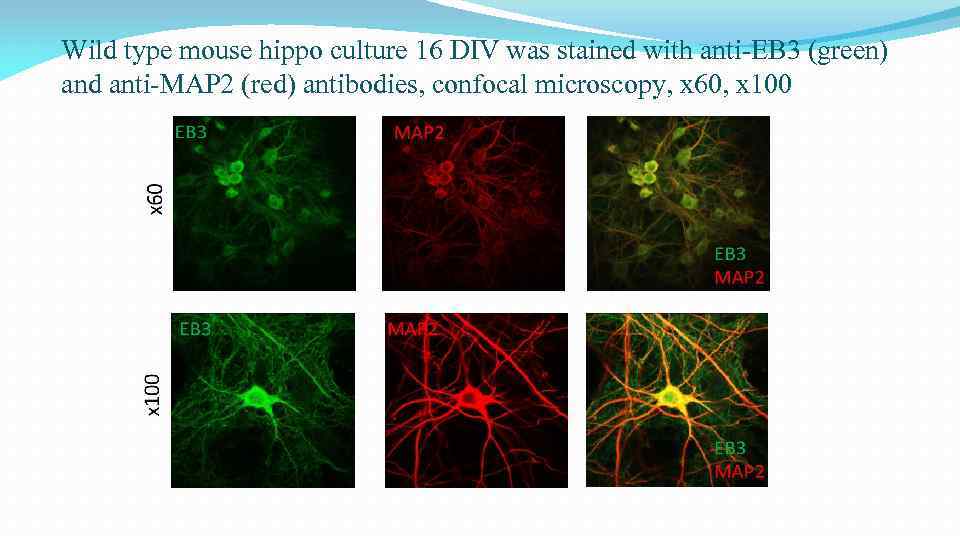 Wild type mouse hippo culture 16 DIV was stained with anti-EB 3 (green) and