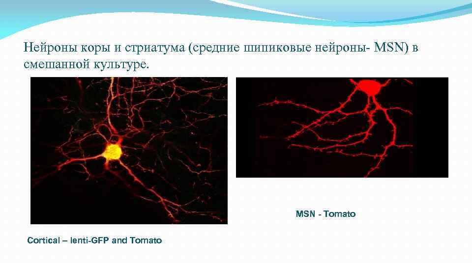 Нейроны коры и стриатума (средние шипиковые нейроны- MSN) в смешанной культуре. MSN - Tomato