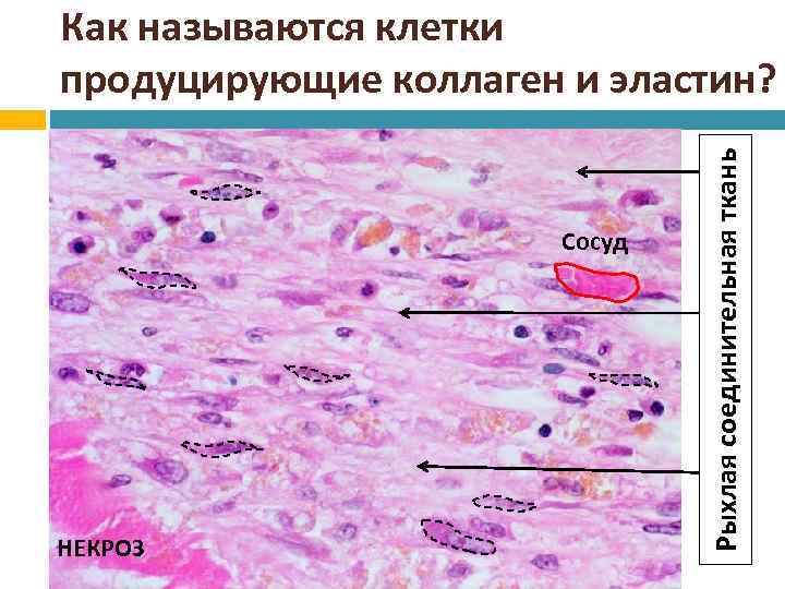 Клетка в таблице поставок которая не удовлетворяет условию оптимальности плана называется клеткой