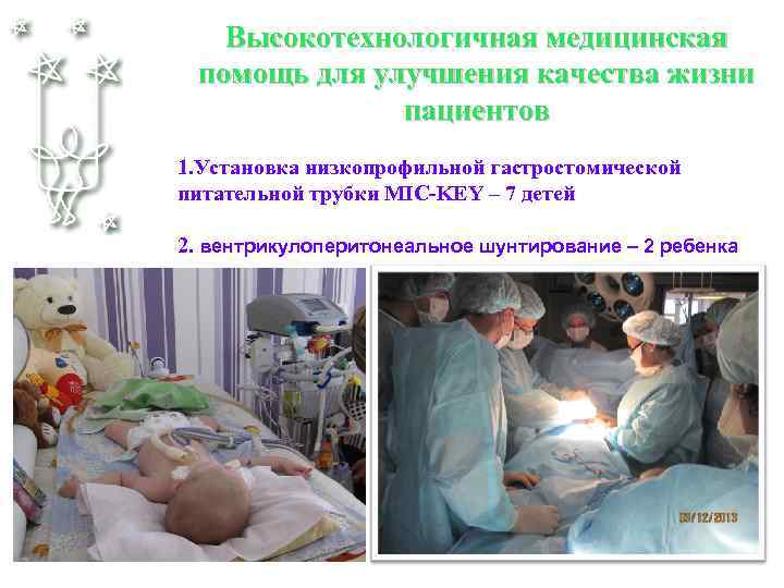 Высокотехнологичная медицинская помощь для улучшения качества жизни пациентов 1. Установка низкопрофильной гастростомической питательной трубки
