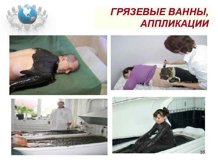 ГРЯЗЕВЫЕ ВАННЫ, АППЛИКАЦИИ 35 