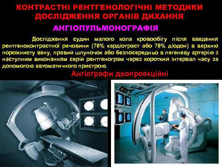 КОНТРАСТНІ РЕНТГЕНОЛОГІЧНІ МЕТОДИКИ ДОСЛІДЖЕННЯ ОРГАНІВ ДИХАННЯ АНГІОПУЛЬМОНОГРАФІЯ Дослідження судин малого кола кровообігу після введення