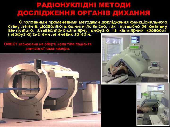 РАДІОНУКЛІДНІ МЕТОДИ ДОСЛІДЖЕННЯ ОРГАНІВ ДИХАННЯ Є головними променевими методами дослідження функціонального стану легенів. Дозволяють