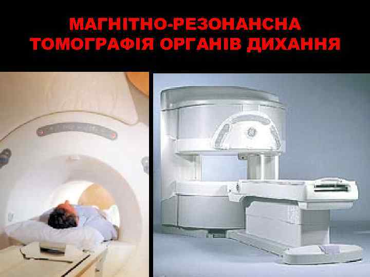 МАГНІТНО-РЕЗОНАНСНА ТОМОГРАФІЯ ОРГАНІВ ДИХАННЯ 