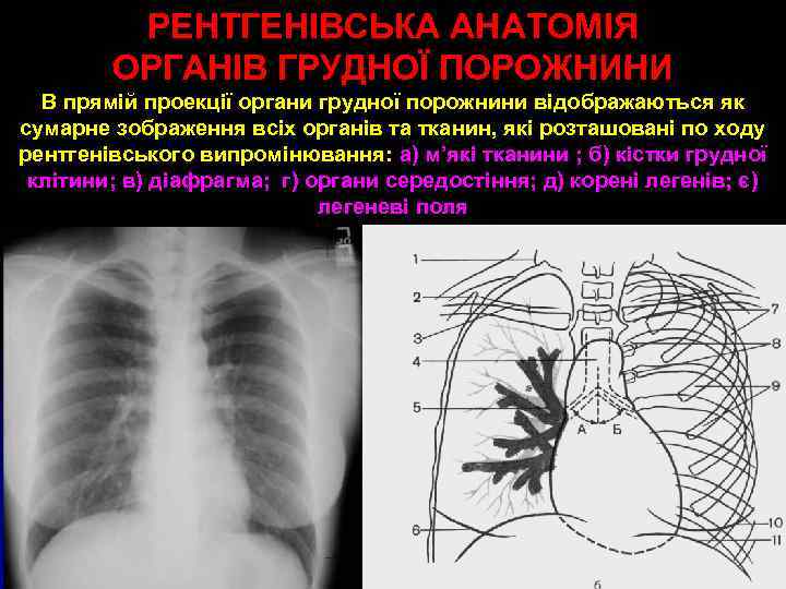 РЕНТГЕНІВСЬКА АНАТОМІЯ ОРГАНІВ ГРУДНОЇ ПОРОЖНИНИ В прямій проекції органи грудної порожнини відображаються як сумарне