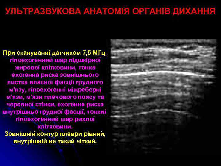УЛЬТРАЗВУКОВА АНАТОМІЯ ОРГАНІВ ДИХАННЯ При скануванні датчиком 7, 5 МГц: гіпоехогенний шар підшкірної жирової