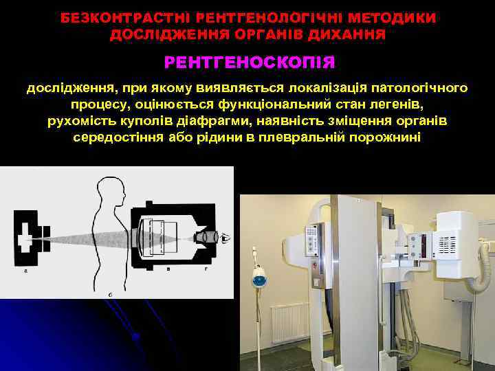 БЕЗКОНТРАСТНІ РЕНТГЕНОЛОГІЧНІ МЕТОДИКИ ДОСЛІДЖЕННЯ ОРГАНІВ ДИХАННЯ РЕНТГЕНОСКОПІЯ дослідження, при якому виявляється локалізація патологічного процесу,