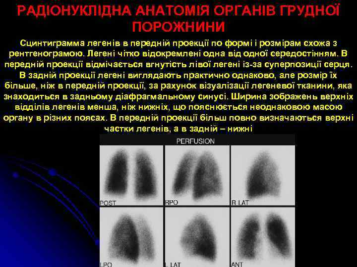 РАДІОНУКЛІДНА АНАТОМІЯ ОРГАНІВ ГРУДНОЇ ПОРОЖНИНИ Сцинтиграмма легенів в передній проекції по формі і розмірам