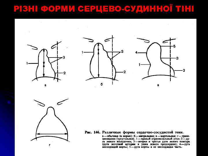 Нормальная конфигурация сердца рисунок