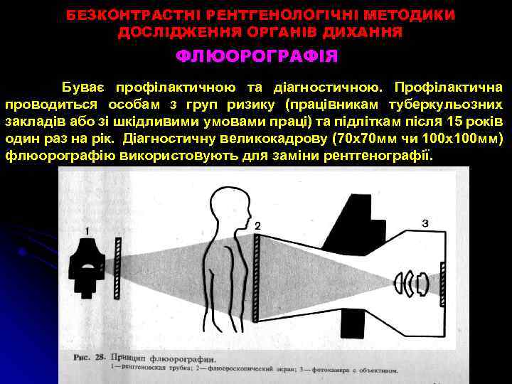 БЕЗКОНТРАСТНІ РЕНТГЕНОЛОГІЧНІ МЕТОДИКИ ДОСЛІДЖЕННЯ ОРГАНІВ ДИХАННЯ ФЛЮОРОГРАФІЯ Буває профілактичною та діагностичною. Профілактична проводиться особам