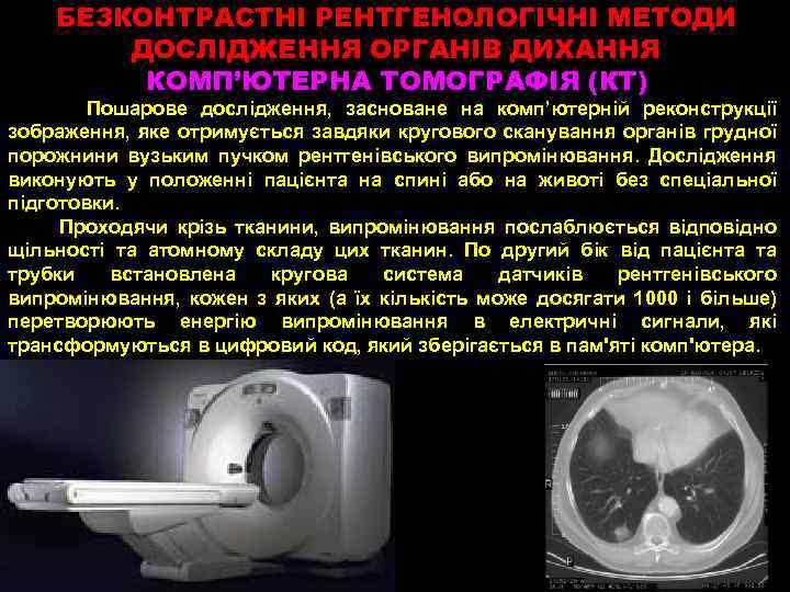 БЕЗКОНТРАСТНІ РЕНТГЕНОЛОГІЧНІ МЕТОДИ ДОСЛІДЖЕННЯ ОРГАНІВ ДИХАННЯ КОМП’ЮТЕРНА ТОМОГРАФІЯ (КТ) Пошарове дослідження, засноване на комп’ютерній
